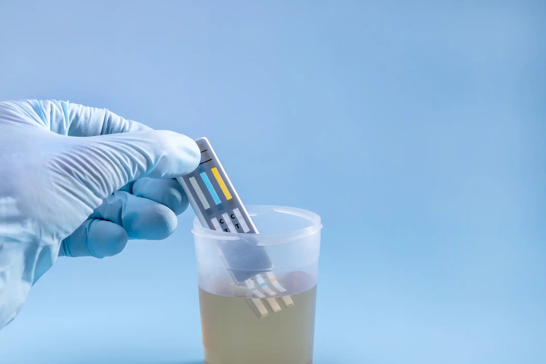 Affordable Alcohol Urine Test in Baton Rouge, LA Affordable Alcohol Urine Test in Baton Rouge, LA