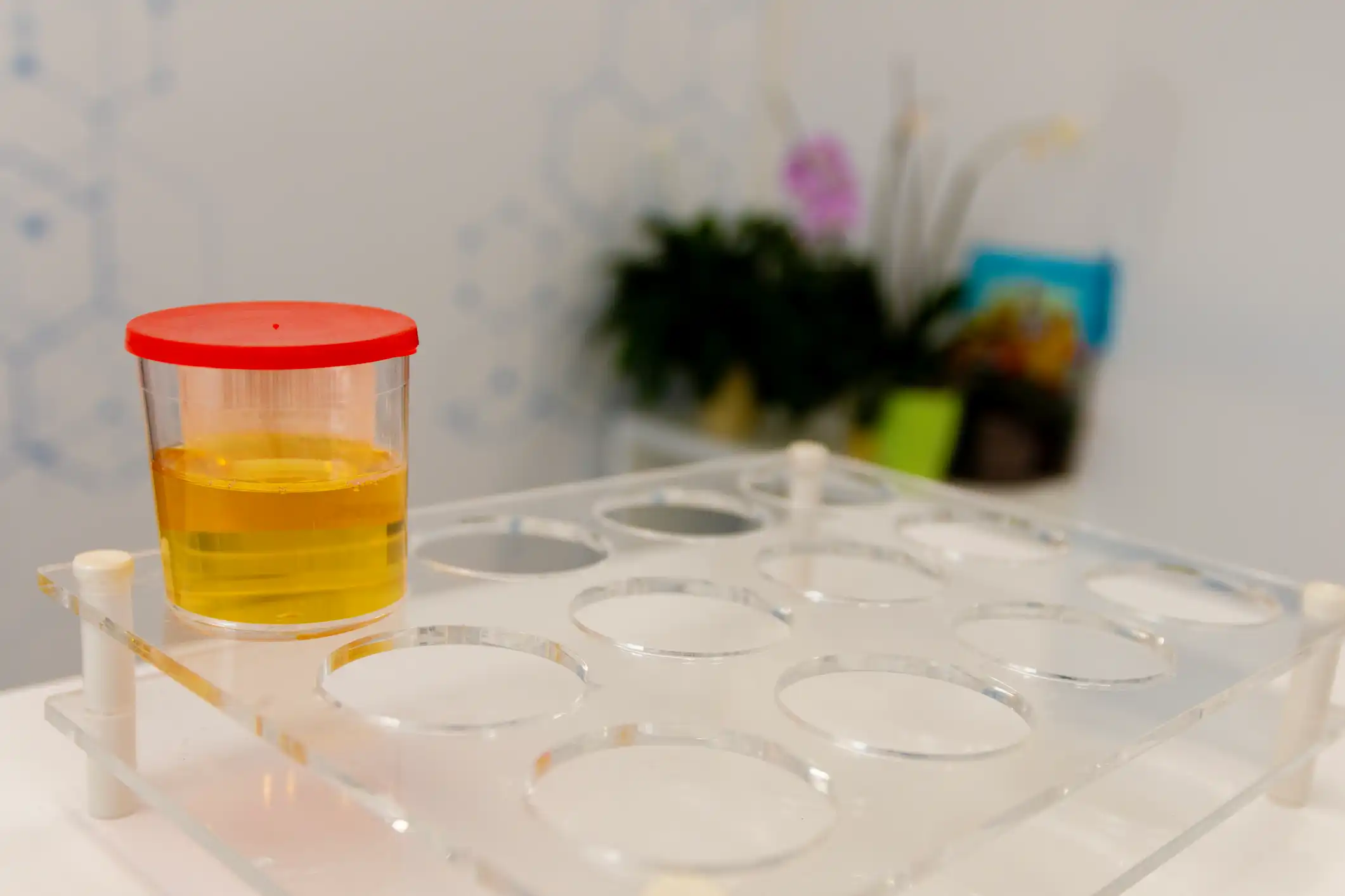 Dependable Alcohol Urine Test in Baton Rouge, LA Dependable Alcohol Urine Test in Baton Rouge, LA