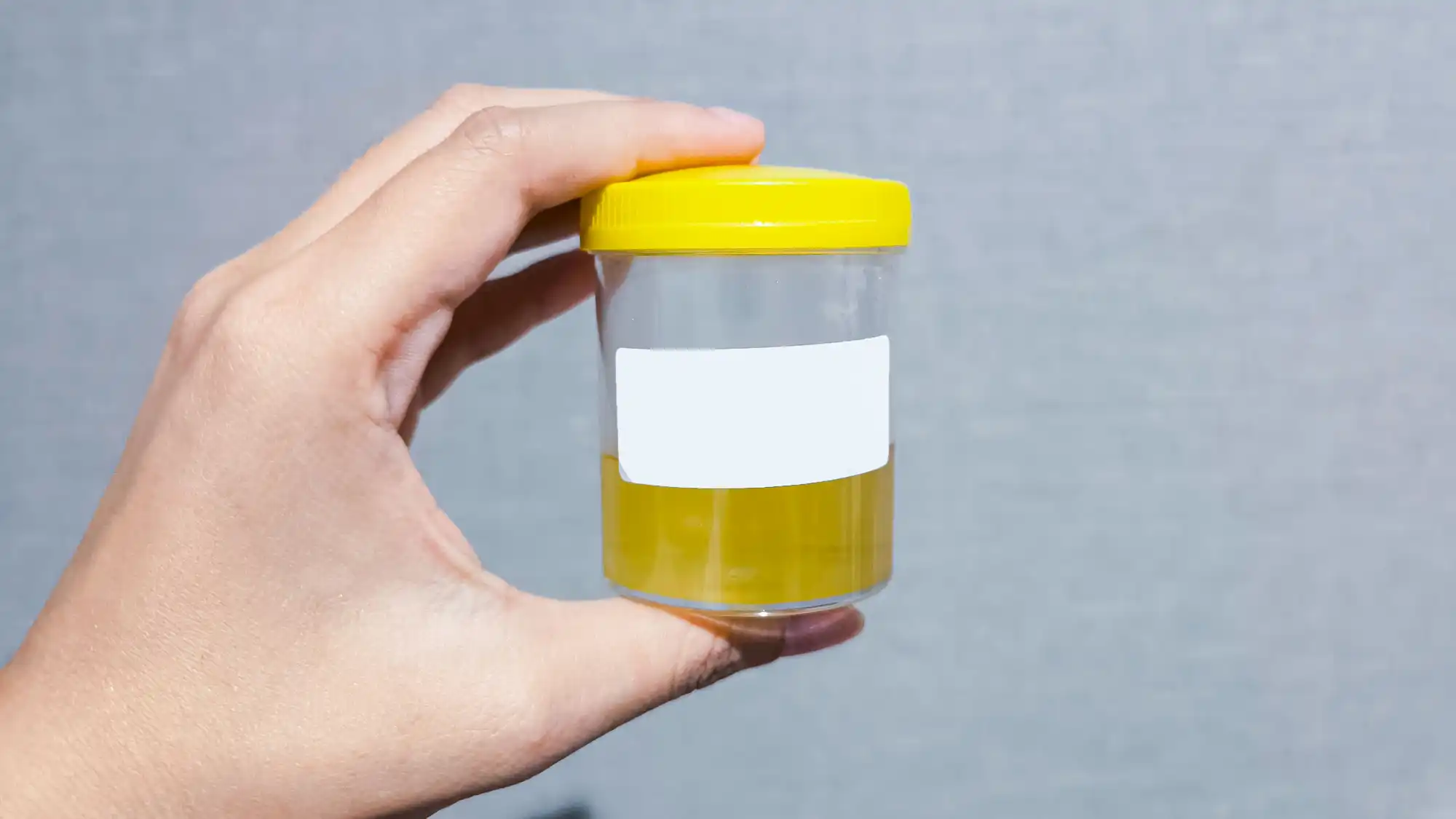 Reliable Alcohol Urine Test in Baton Rouge, LA Reliable Alcohol Urine Test in Baton Rouge, LA