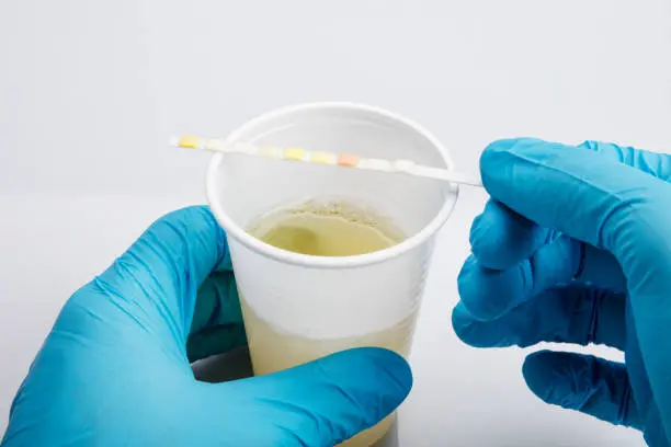 Understanding the Accuracy of Alcohol Urine Testing in Baton Rouge, LA Understanding the Accuracy of Alcohol Urine Testing in Baton Rouge, LA
